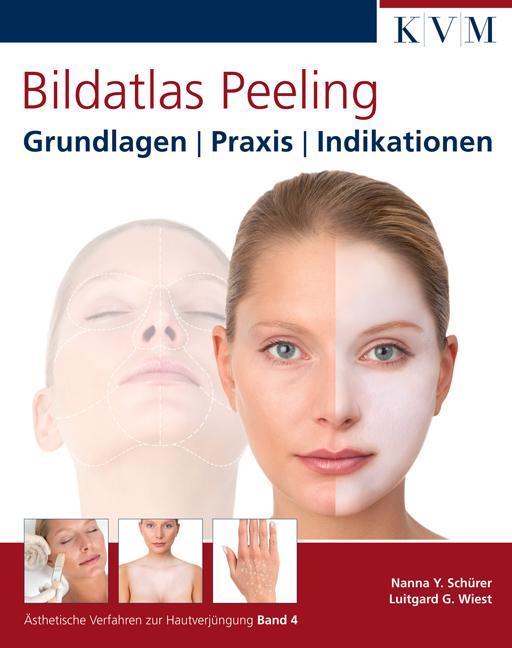 Bildatlas Peeling