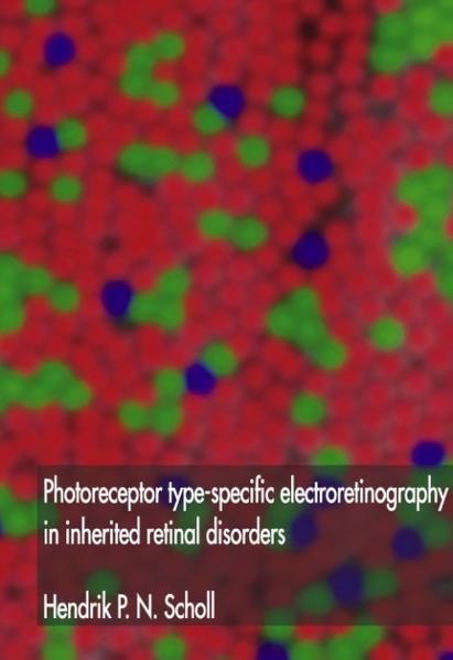 Photoreceptor type-specific electroretinography in inherited retinal disorders