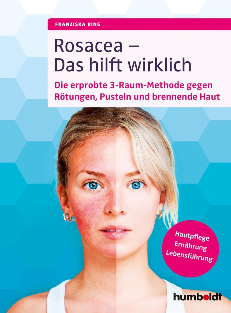 Rosacea - Das hilft wirklich