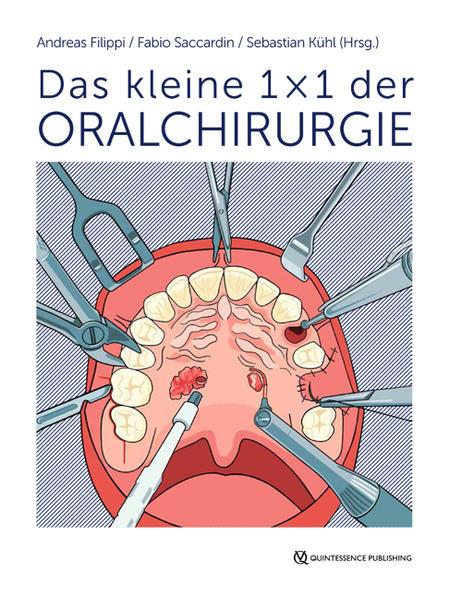 Das kleine 1 × 1 der Oralchirurgie