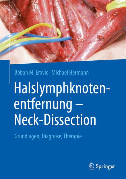 Halslymphknotenentfernung Neck-Dissection