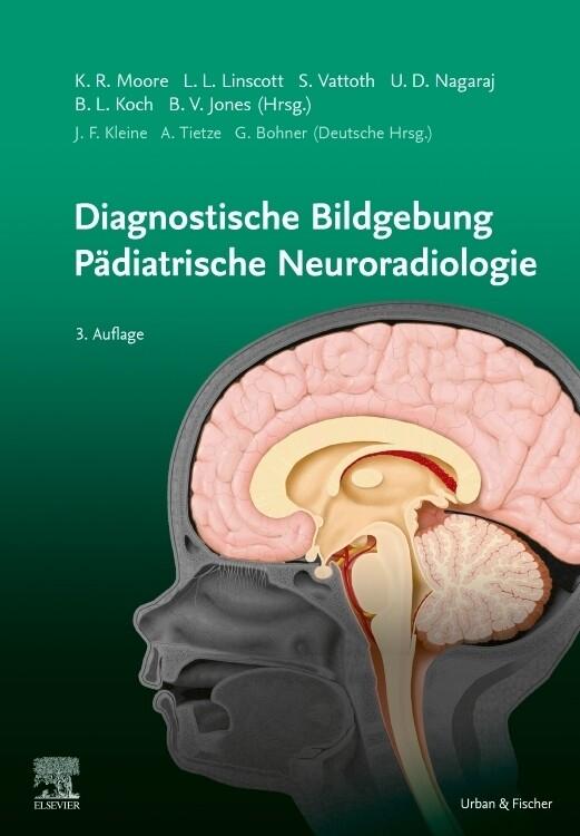 Diagnostische Bildgebung Pädiatrische Neuroradiologie