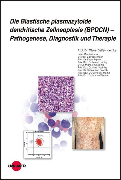 Die Blastische plasmazytoide dendritische Zellneoplasie (BPDCN) - Pathogenese, Diagnostik und Therapie