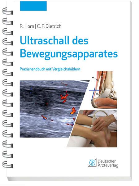 Ultraschall des Bewegungsapparates