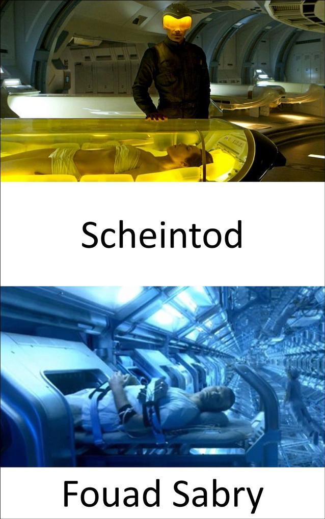 Scheintod