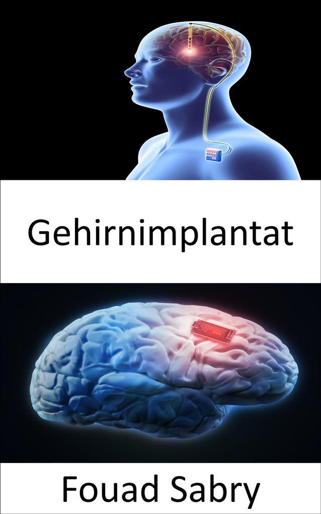 Gehirnimplantat