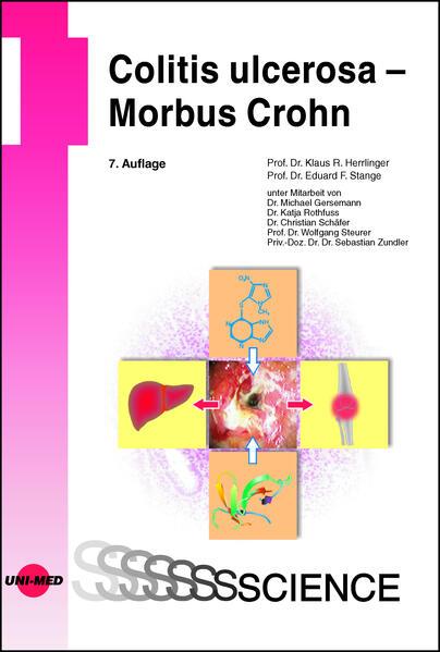 Colitis ulcerosa - Morbus Crohn