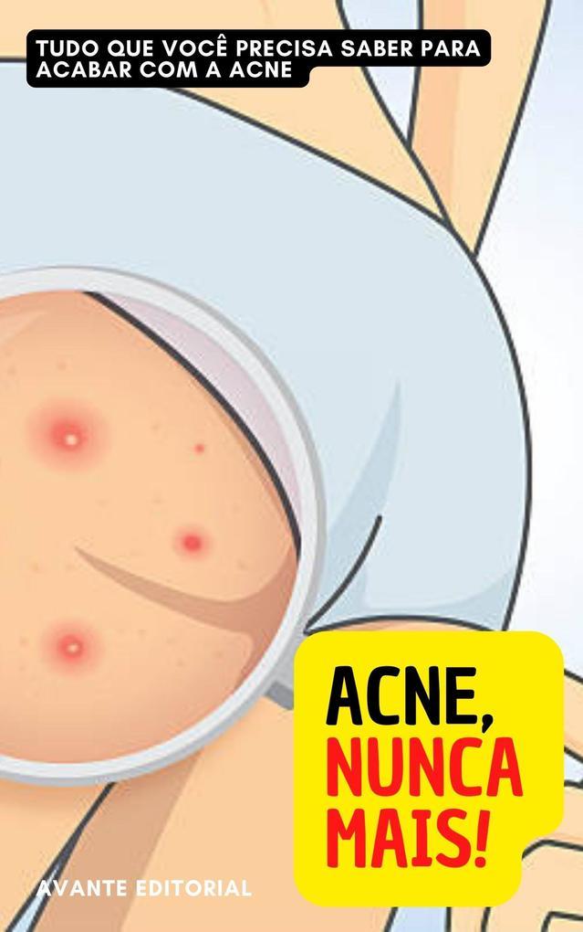 Acne, Nunca Mais!