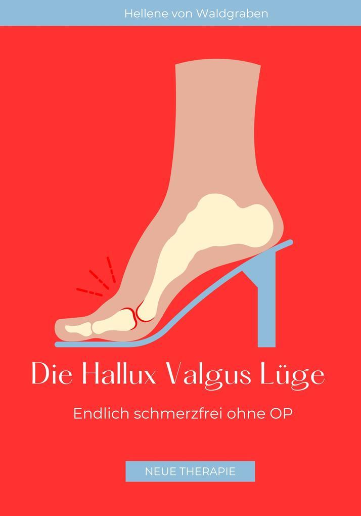 Die Hallux Valgus Lüge: Endlich schmerzfrei ohne OP,: Medizinisches Grundwissen und Therapie NEU 2024