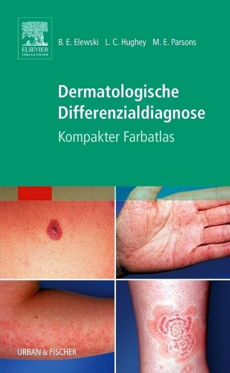 Dermatologische Differenzialdiagnose