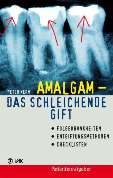 Amalgam - das schleichende Gift