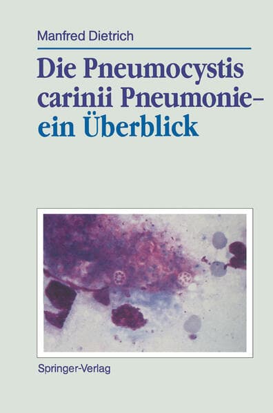 Die Pneumocystis carinii Pneumonie ein Überblick