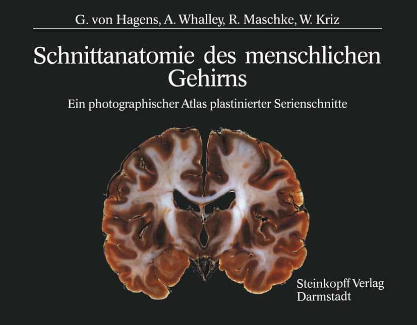 Schnittanatomie des menschlichen Gehirns