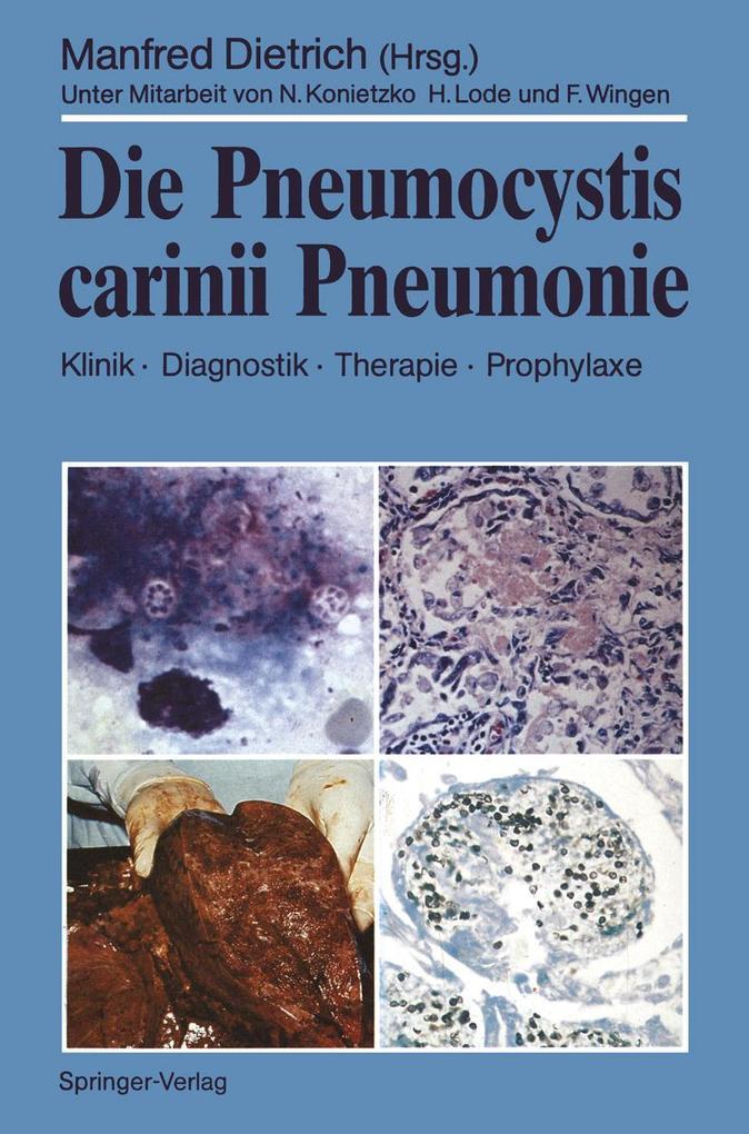 Die Pneumocystis carinii Pneumonie