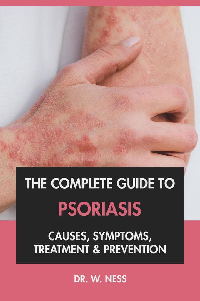 The Complete Guide to Psoriasis: Causes, Symptoms, Treatment & Prevention